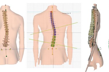 Wirbelsäulenscan | © DIERS